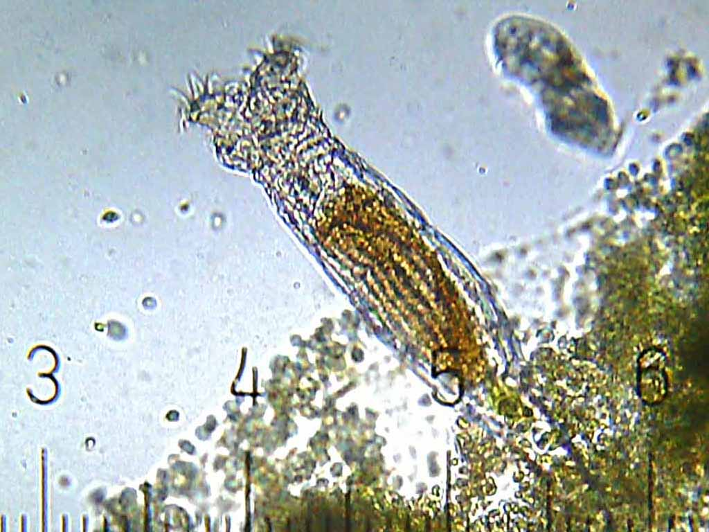 Bdelloid Rotifers 